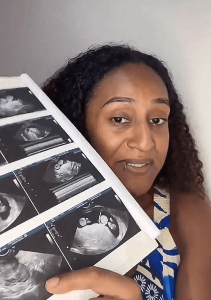 Женщина показывает снимки УЗИ с разницей в развитии плодов Женщина держит распечатанные снимки УЗИ, подтверждающие редкий случай беременности